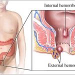 Anorectal 01