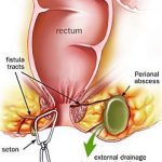 Anorectal 02