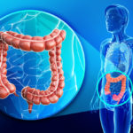 colorectal