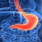 gastro2015-66361