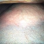 Cytsic-Liver-02