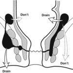 A78842_2_En_13_Fig4_HTML