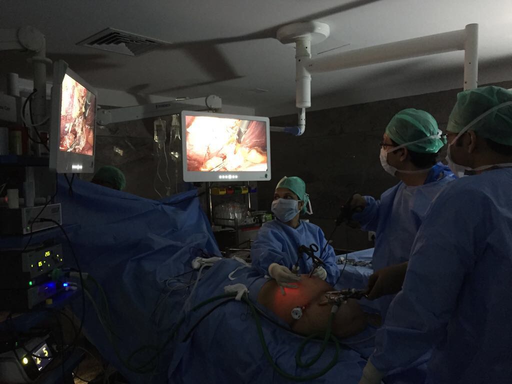Laproscopic operation