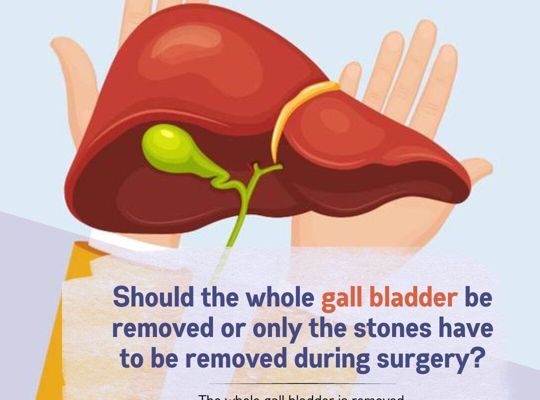 Gall bladder surgery in Dubai