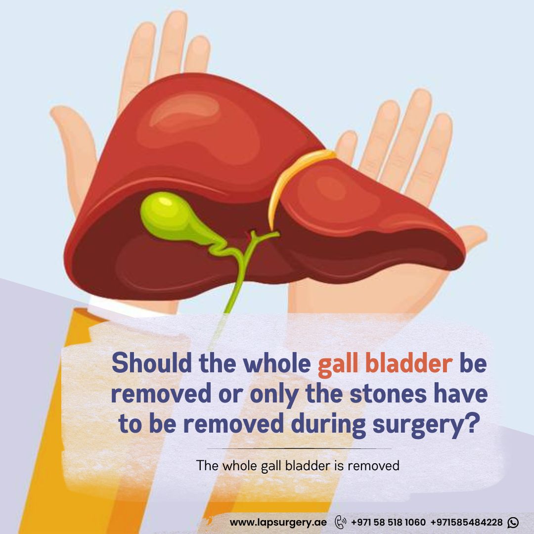 Gall bladder surgery in Dubai