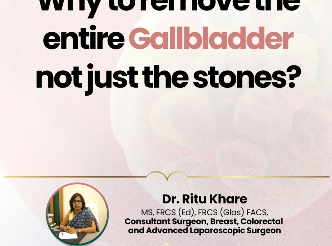 Gallbladder Removal Surgery Dubai