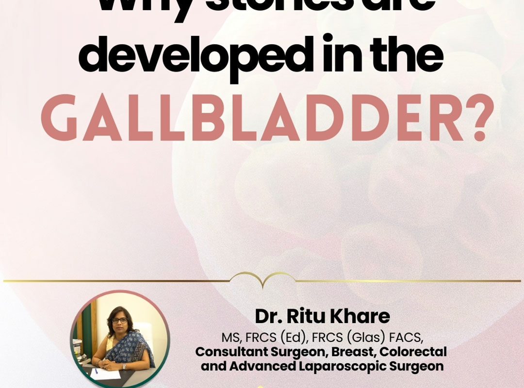 Why stones are developed in the Gallbladder