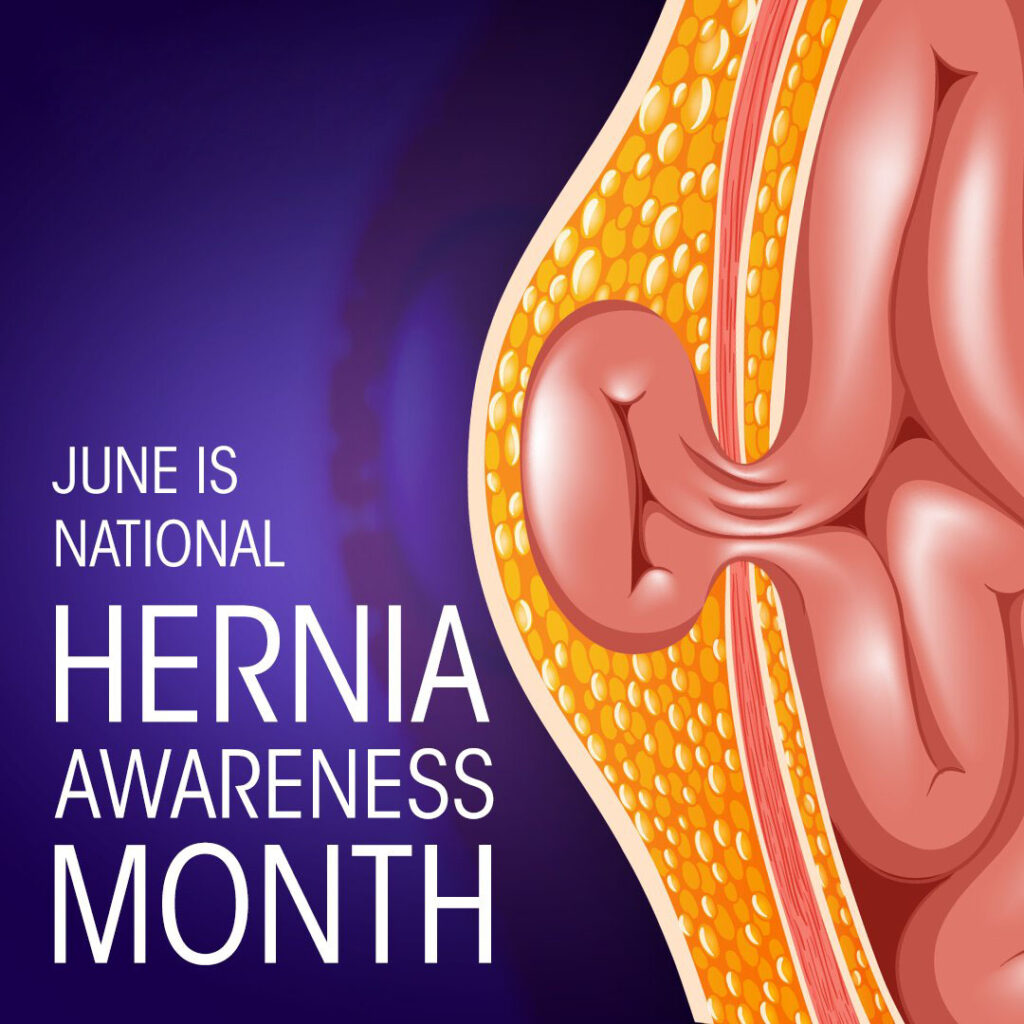 Hernia Awareness Month