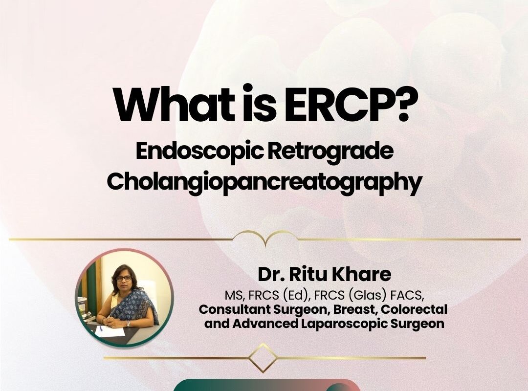 What is ERCP?