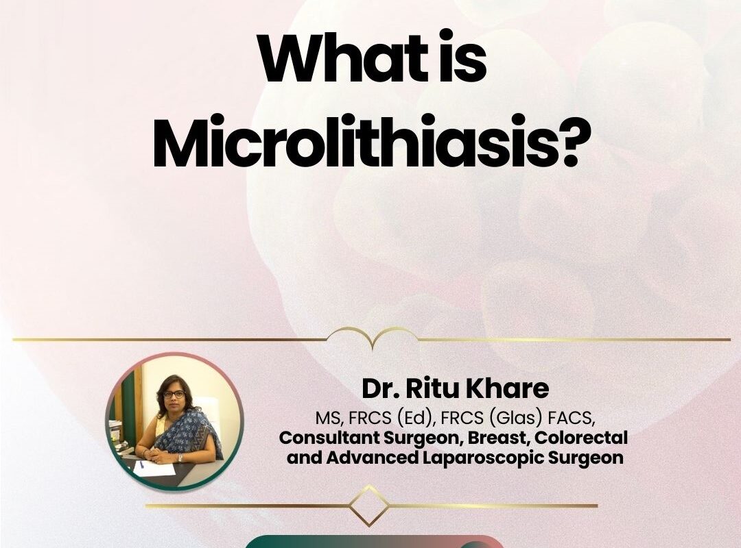 What is Microlithiasis?