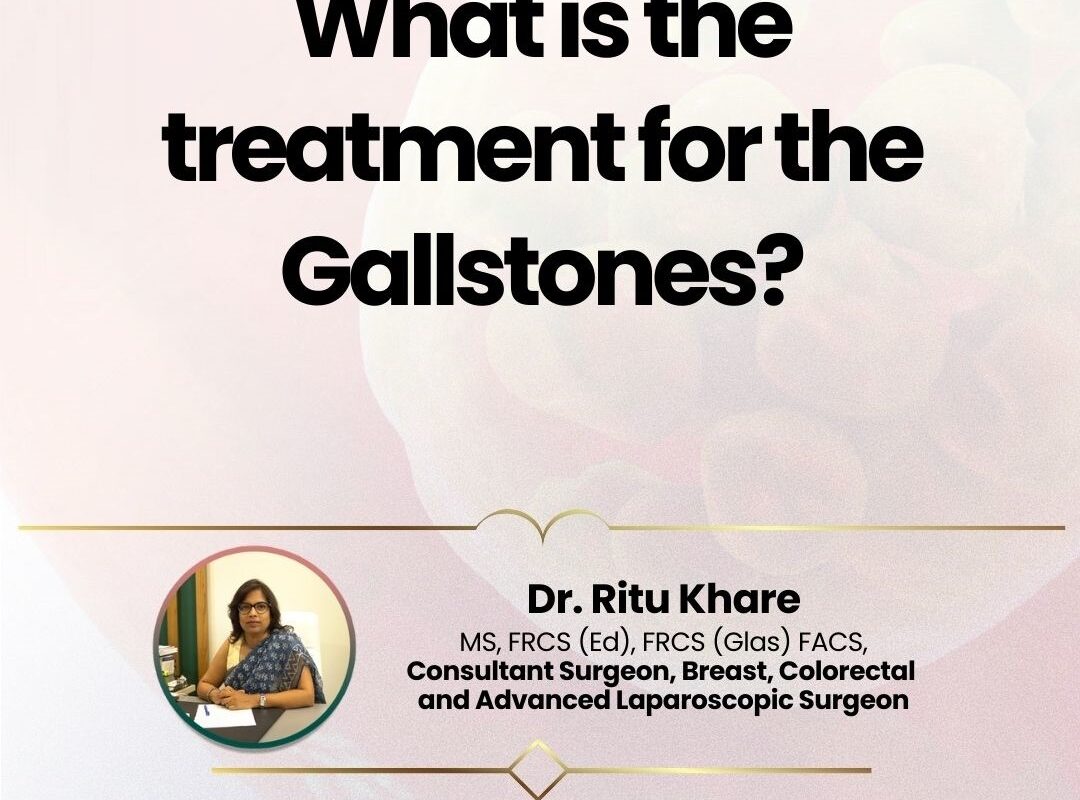 What is the treatment for the Gallstones?